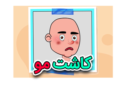 موشن گرافیک کاشت مو