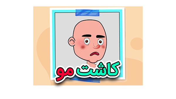 موشن گرافیک کاشت مو 1 موشن گرافیک کاشت مو